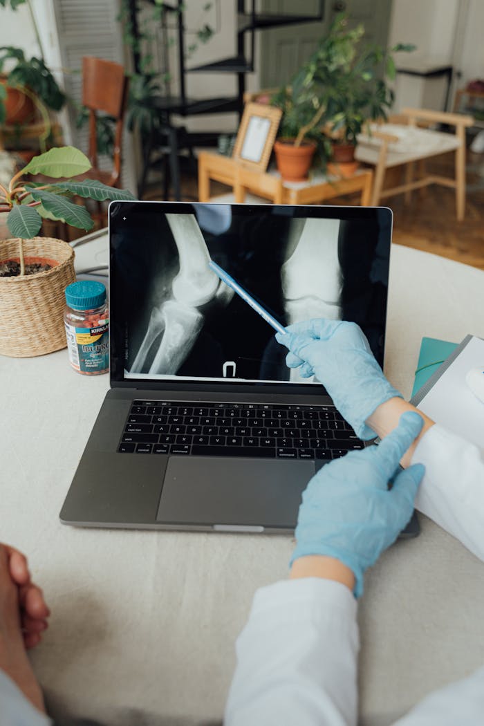 services-02 A doctor in gloves analyzing a knee X-ray on a laptop, emphasizing telemedicine and digital healthcare.